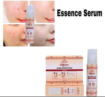 Collagen Plus Vitamin C & E – Original Acne Removal & Brightening Serum