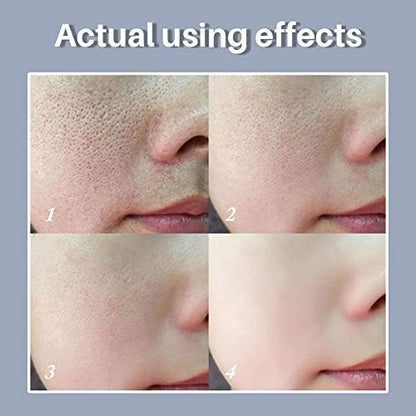 Pore Solution Serum (Original)